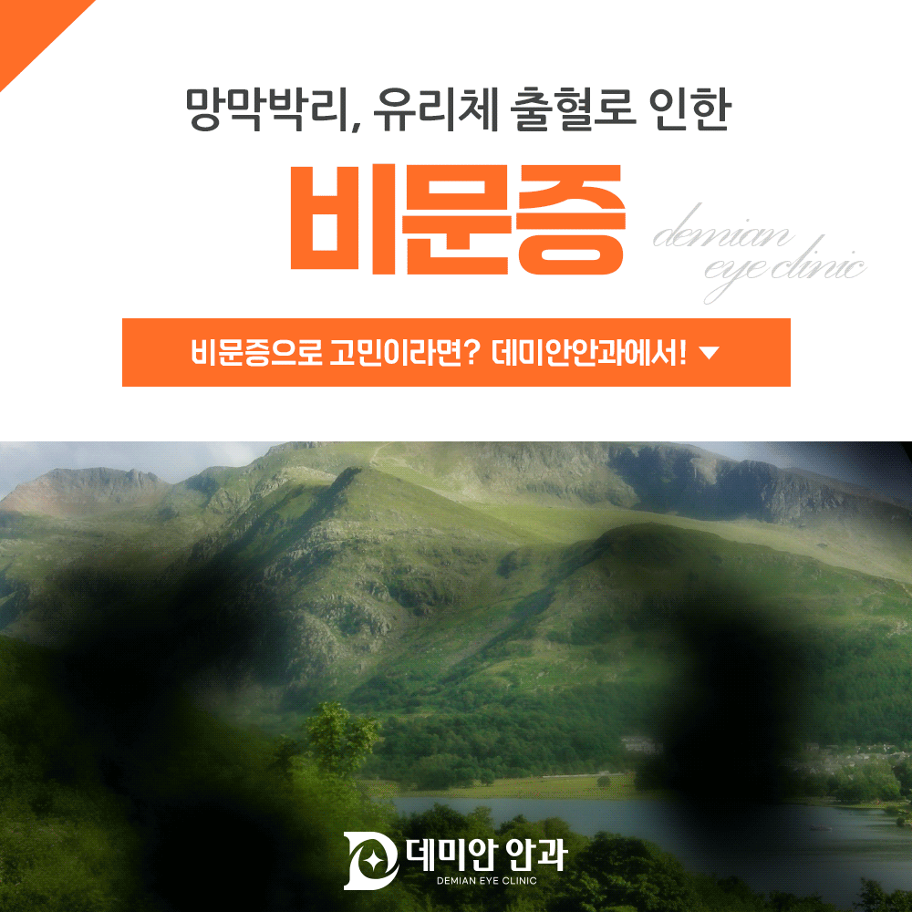 이미지 없음