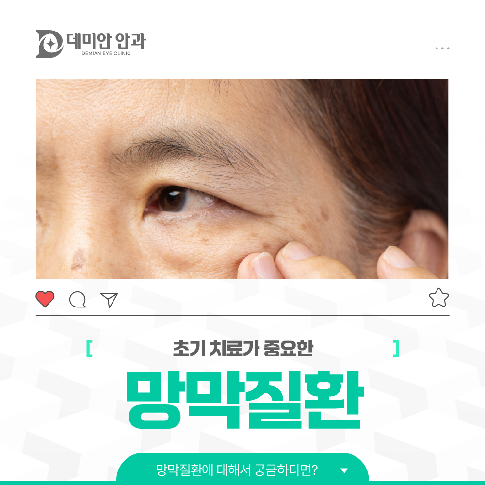 이미지 없음