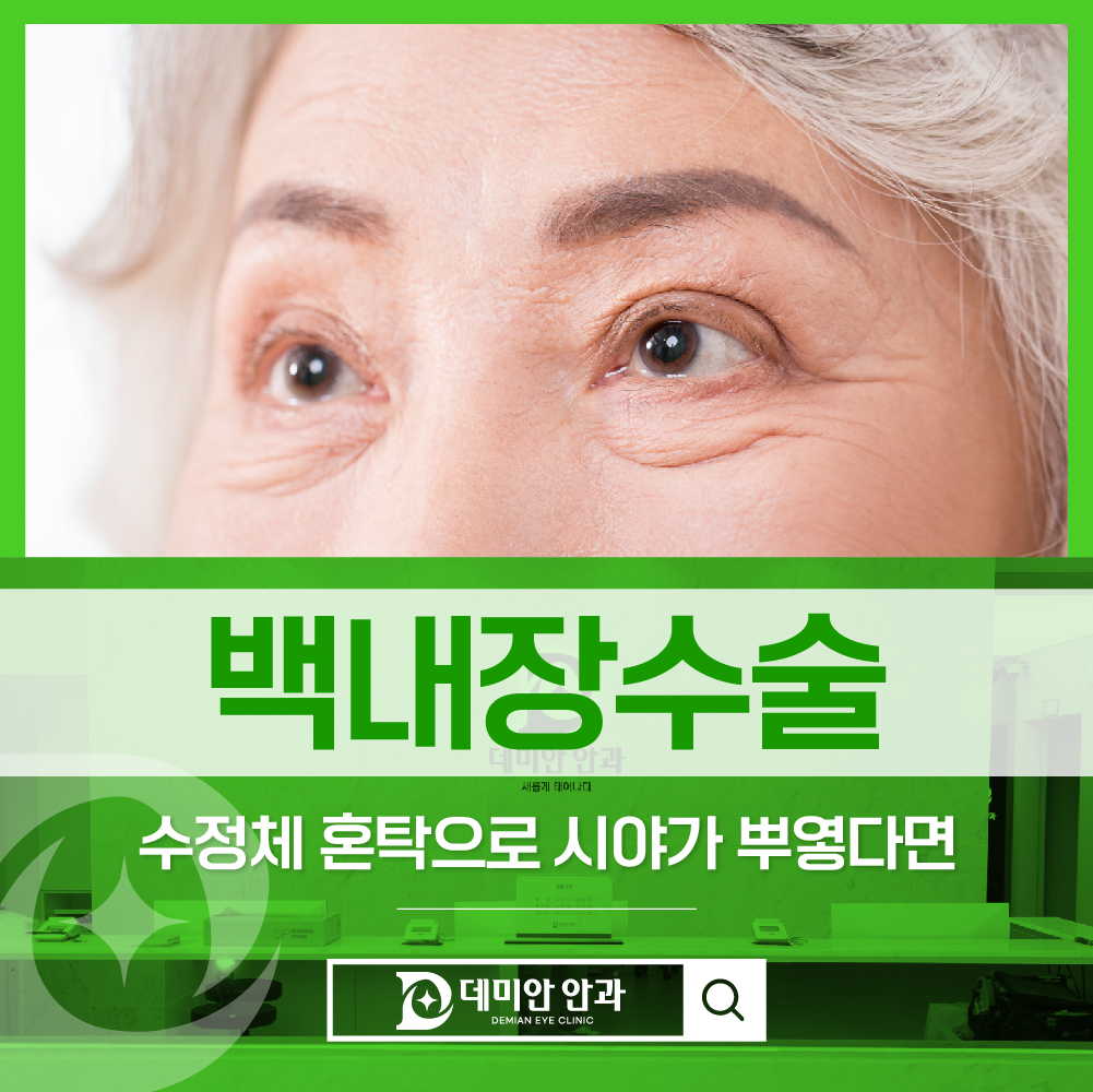 이미지 없음