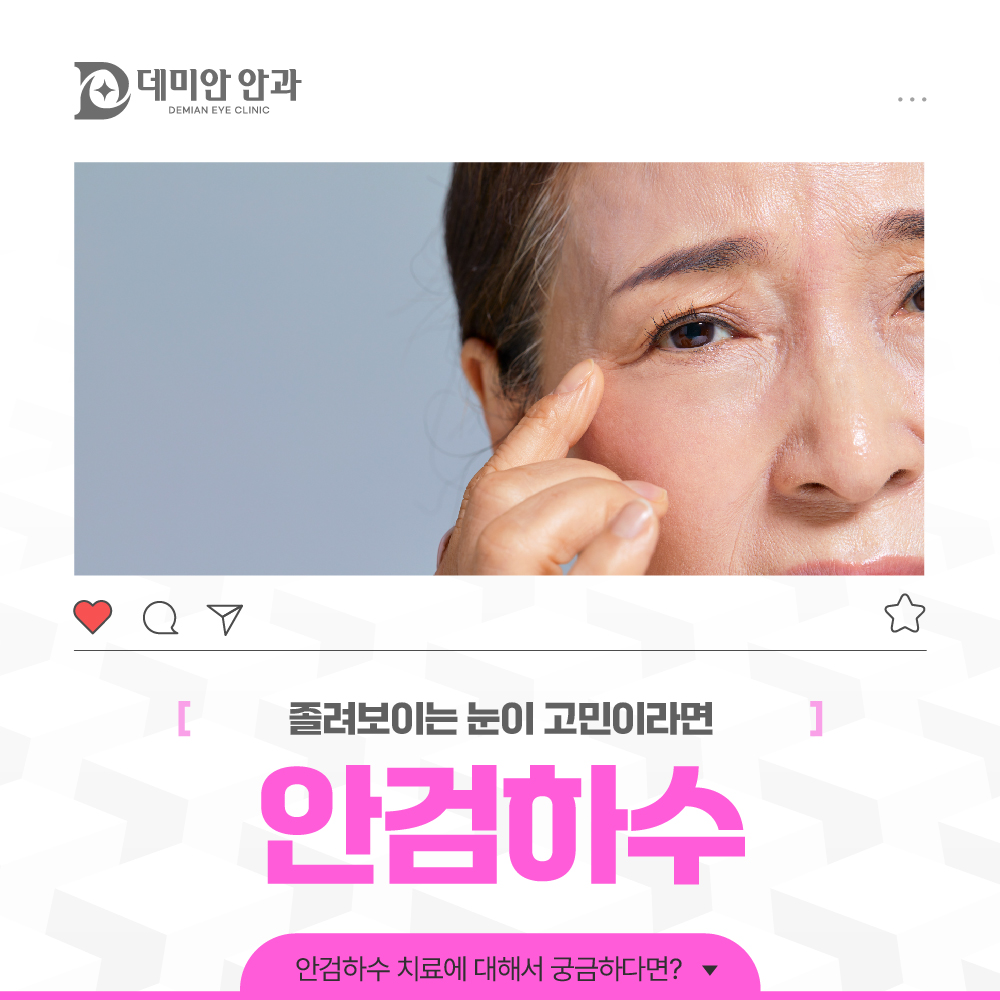 이미지 없음
